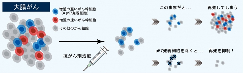 ⼤腸がん再発の原因となるがん幹細胞を発⾒ | 研究成果 | 九州